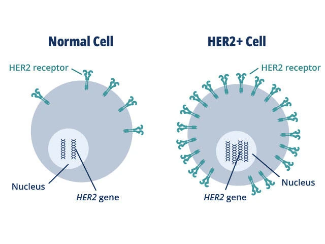Image showing the difference in HER2 expression in a normal cell vs a HER2-positive cancer cell