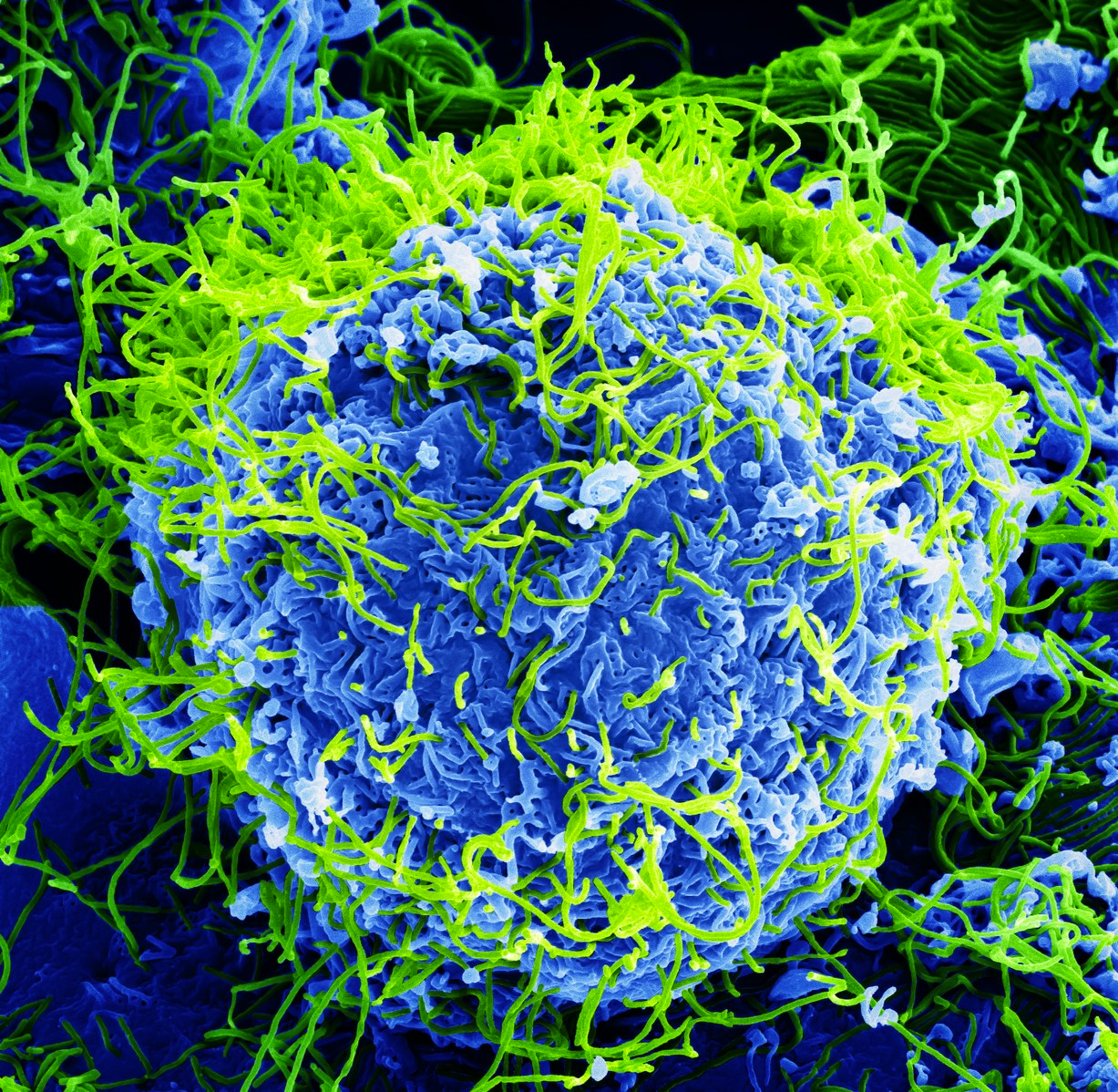 Image of the Ebola virus by BernbaumJG.
